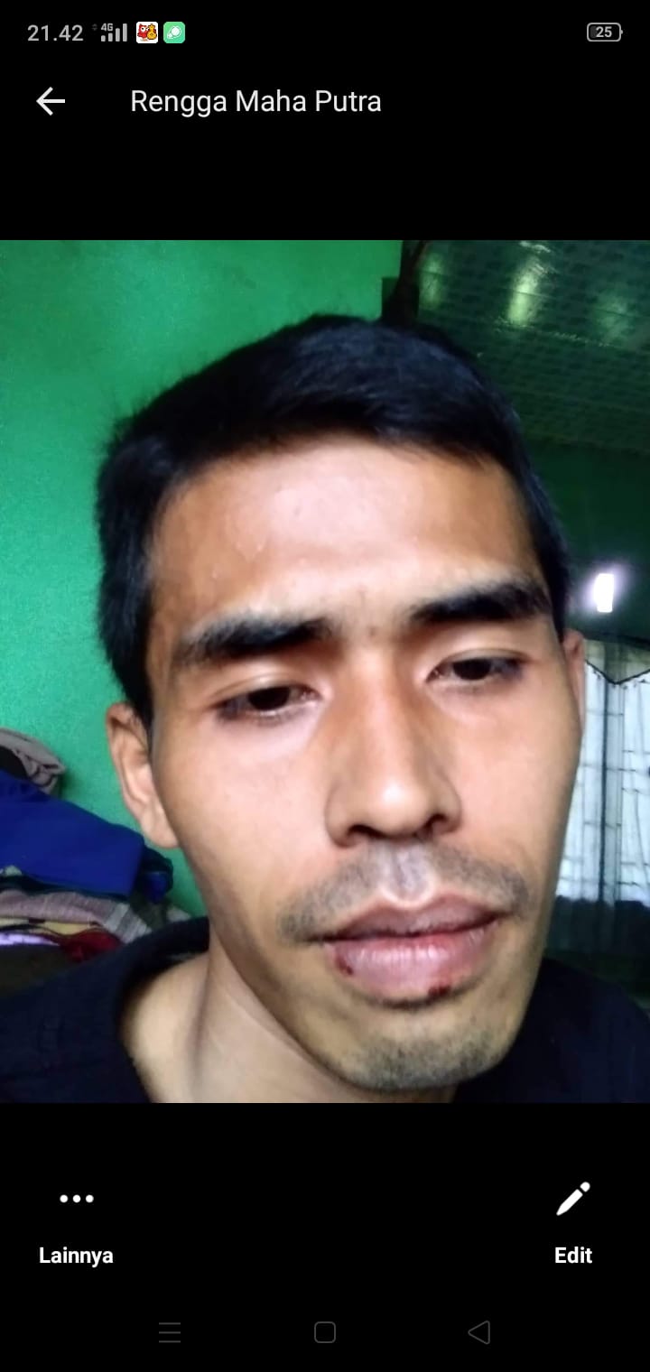 BREAKING NEWS: Oknum Polisi di Rokan Hulu Riau Berubah Jadi Sambo! Pukul Warga Sampai Babak Belur