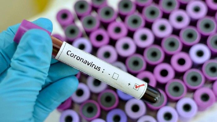 Jika Ada Pasien Yang Terkonfirmasi Virus Corona di Riau Biayanya Akan Ditanggung Pemerintah