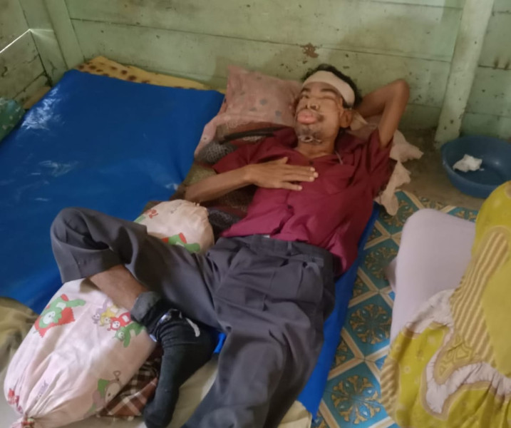 Perjuangan Eni Marlina: Istri yang Menjadi Tulang Punggung Di Tengah Derita Suami Yang Mengidap Tumor Ganas